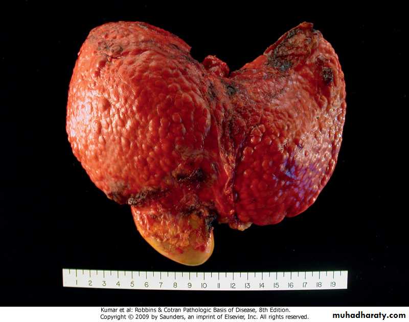 LIVER