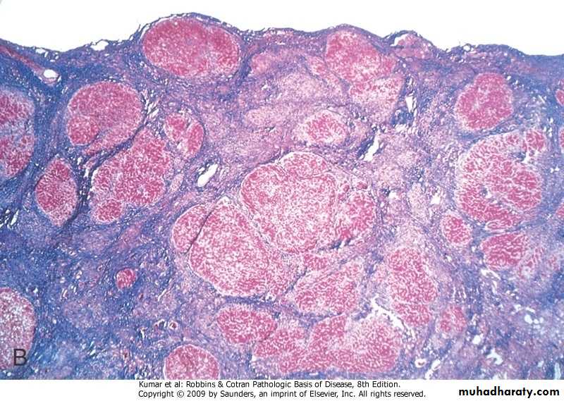LIVER