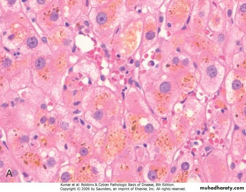 LIVER