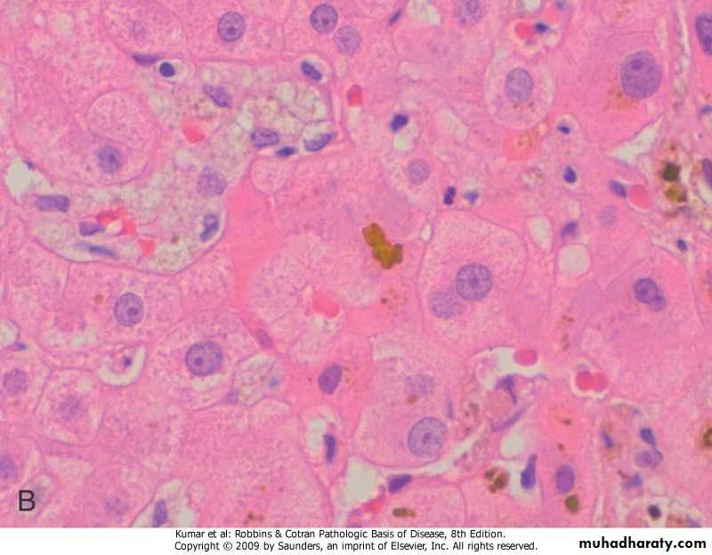 LIVER