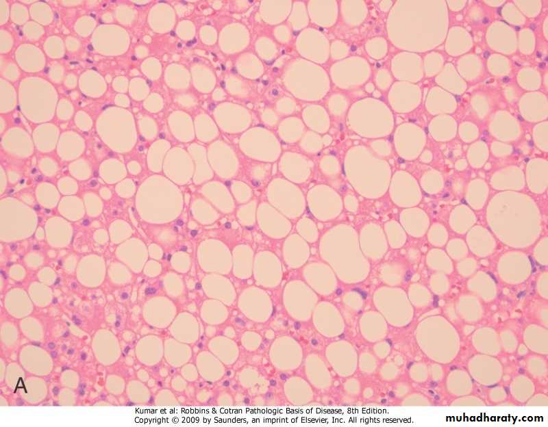 LIVER