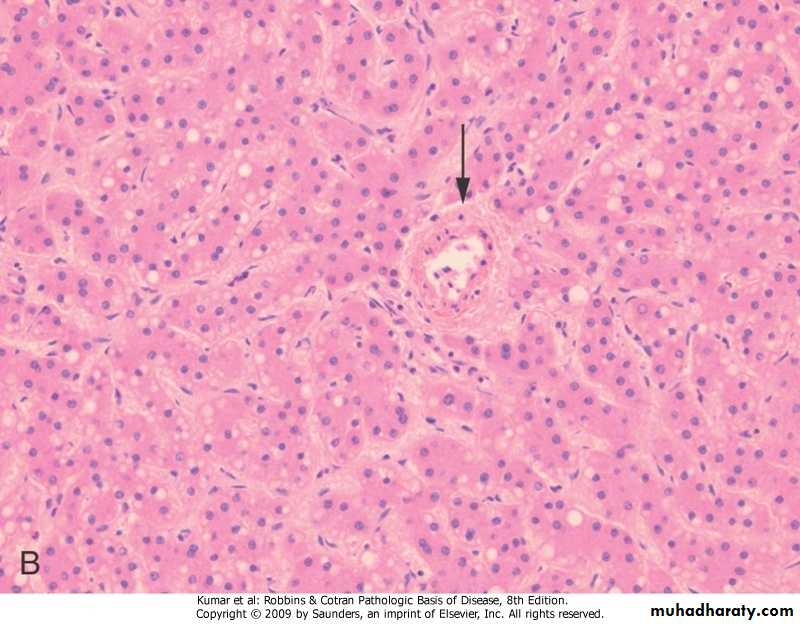LIVER