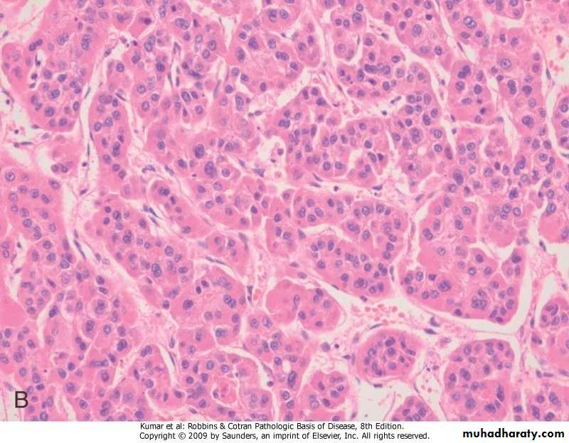 LIVER
