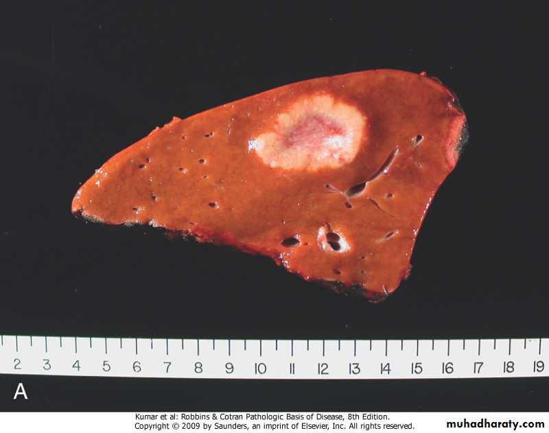LIVER