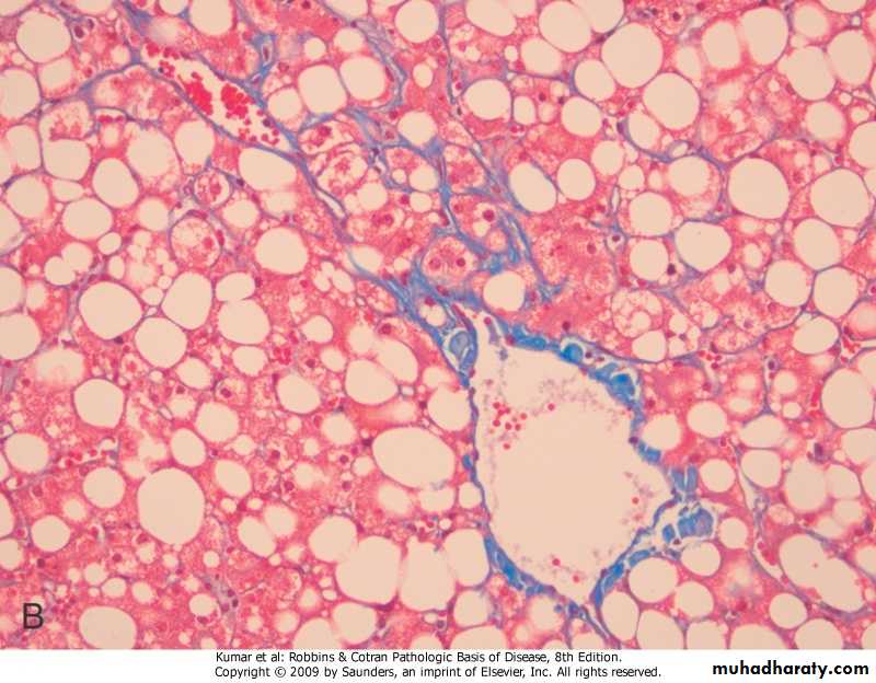 LIVER