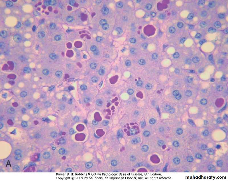 LIVER