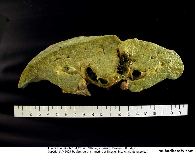 LIVER