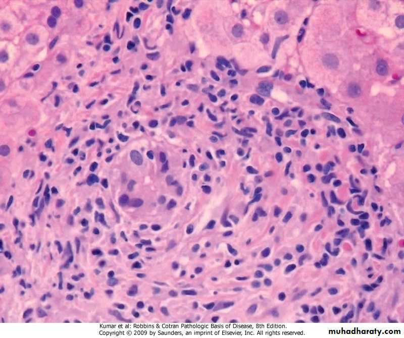 LIVER