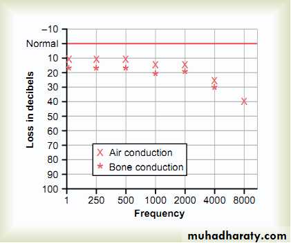 Auditory system test