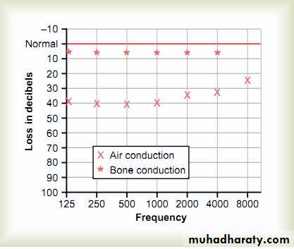 Auditory system test