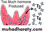 thyroid g