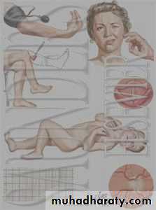 thyroid gland