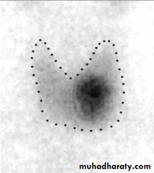 thyroid gland