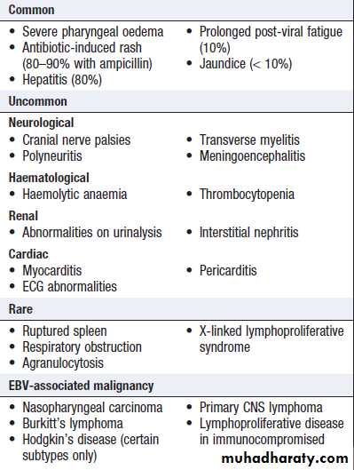 Infectious mononucleosis