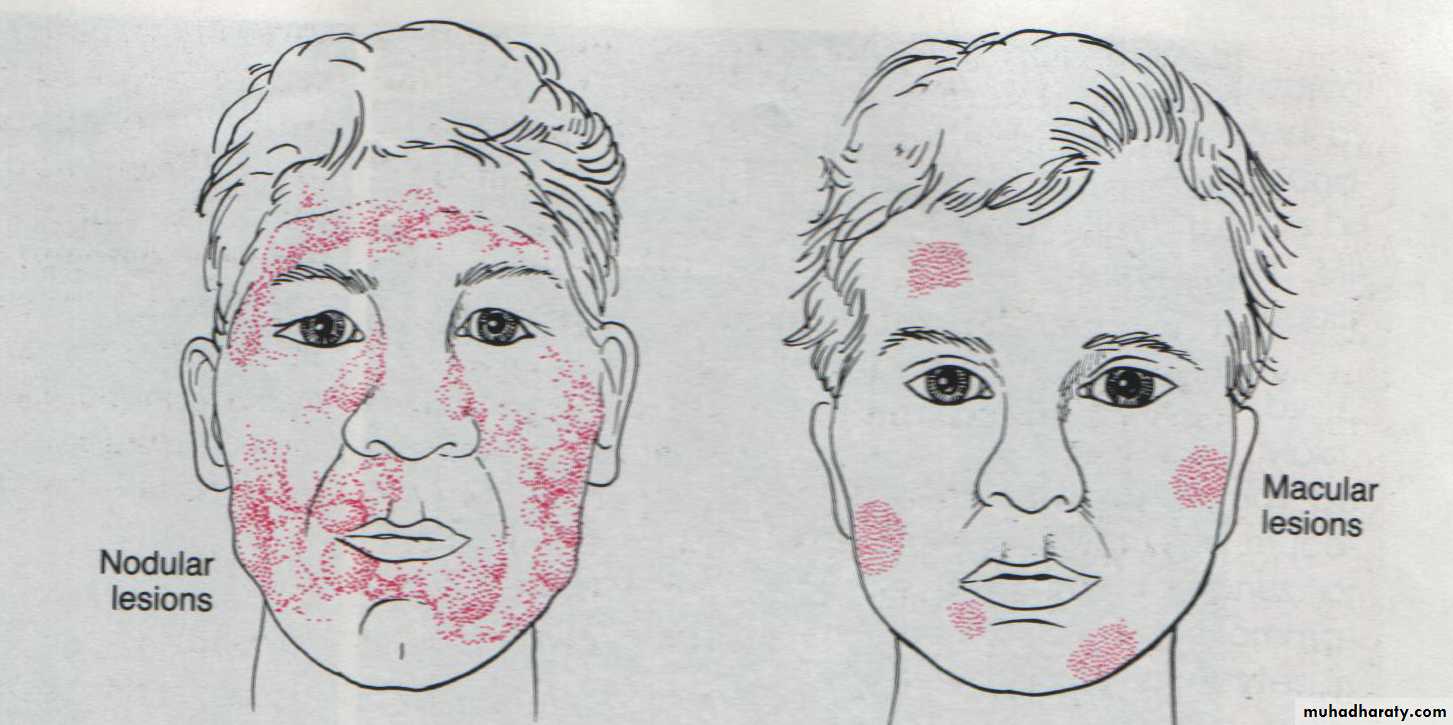 infectious diseases
