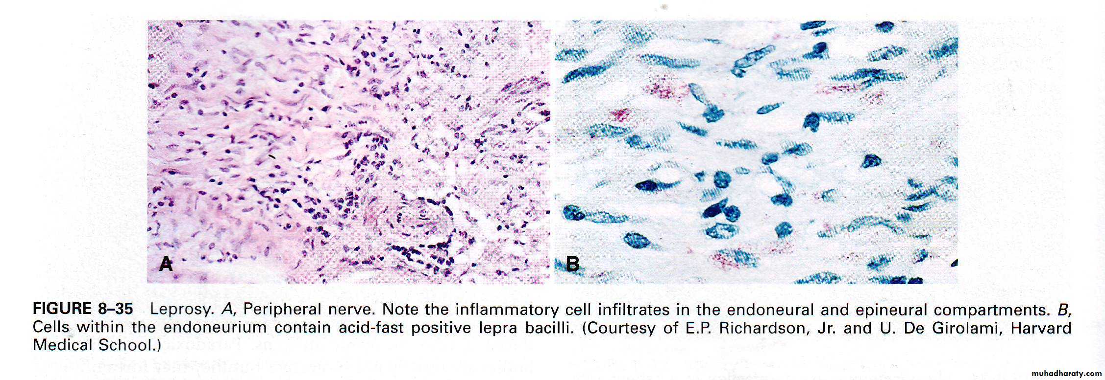 infectious diseases