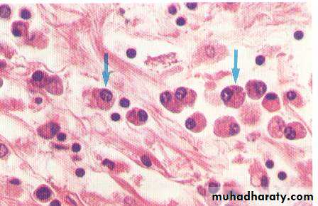 infectious diseases