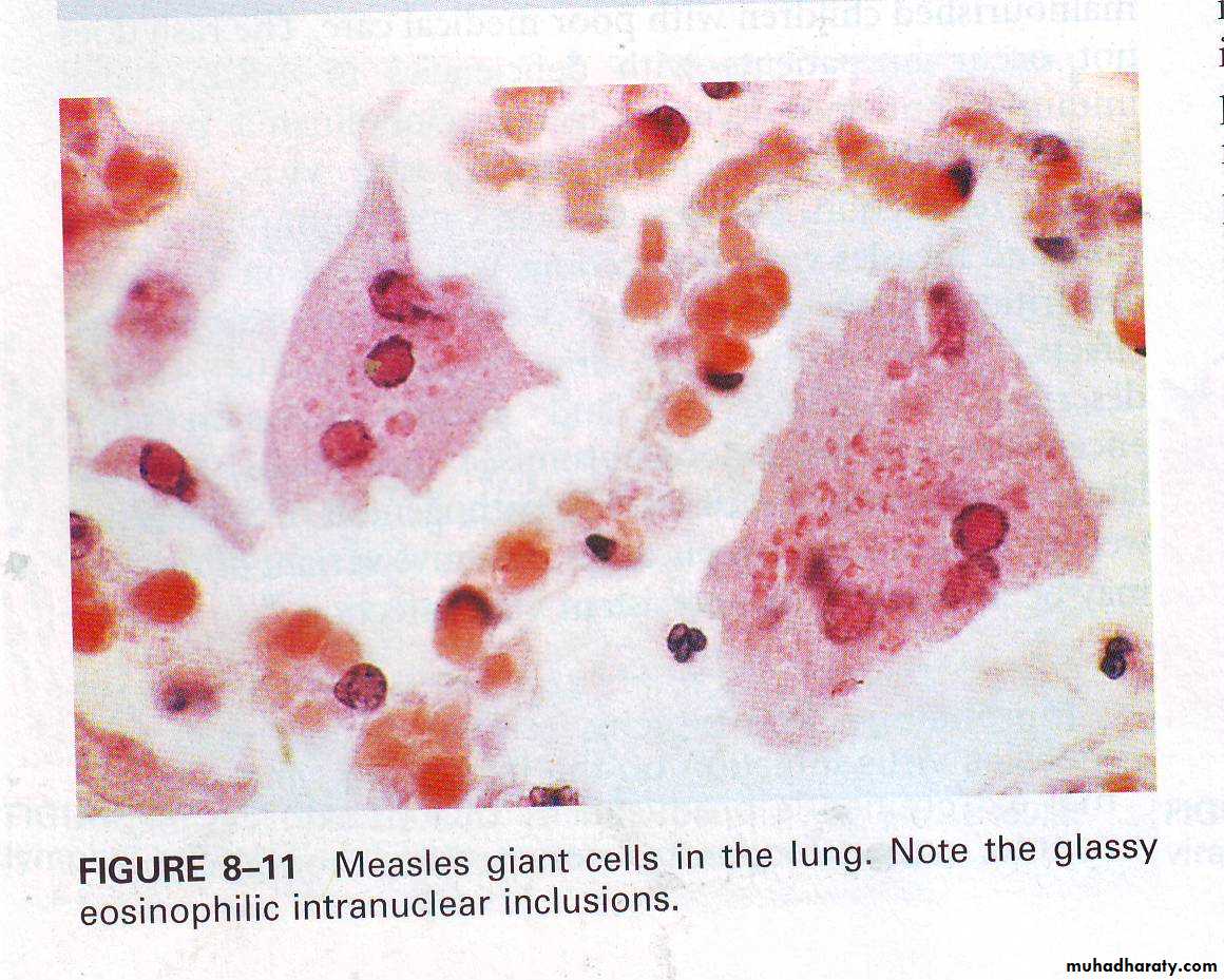 infectious diseases