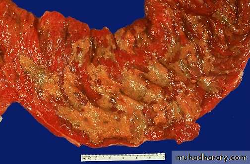infectious diseases