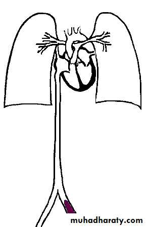 Hemodynamic Disorders