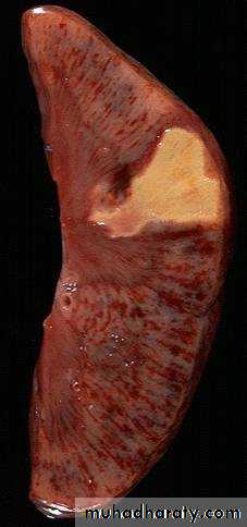 Hemodynamic Disorders