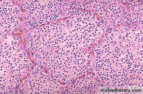 inflammation