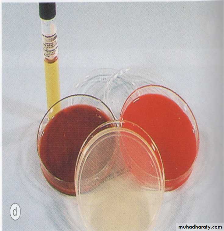cornea