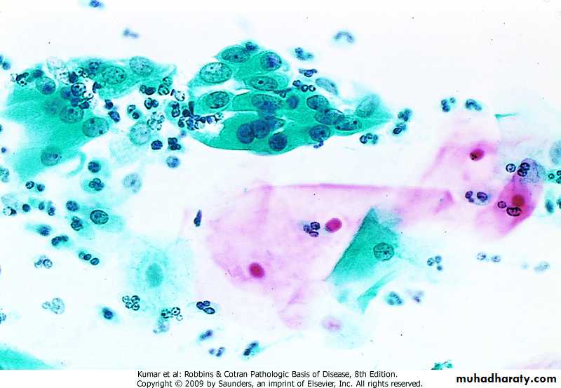 Oncology