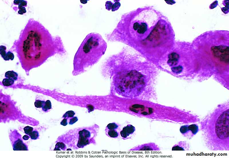 Oncology