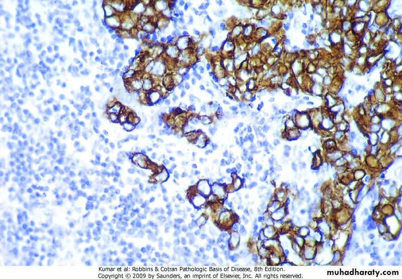 Oncology