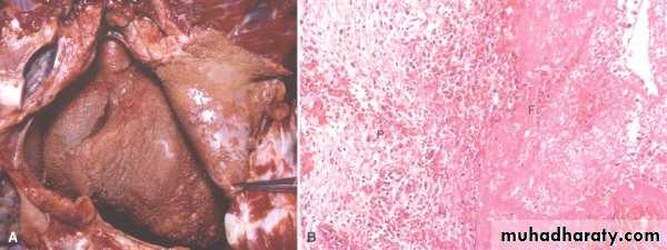 inflammation