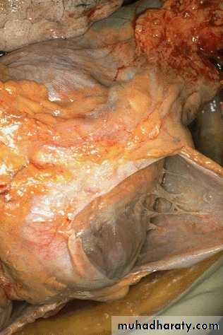inflammation
