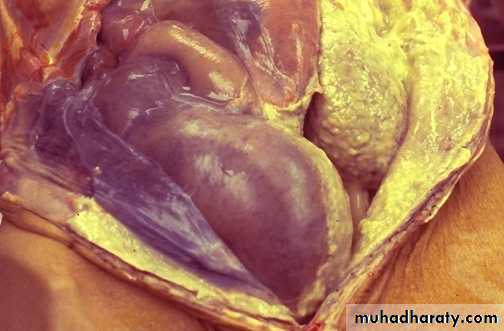 inflammation