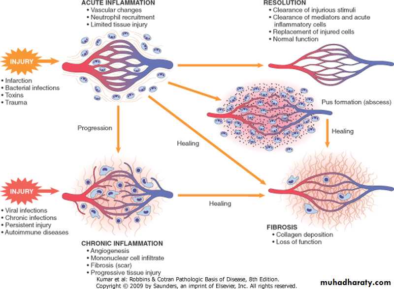 inflammation