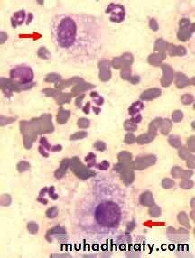 inflammation