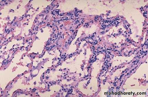 inflammation