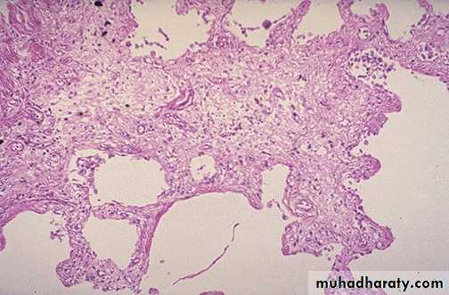 inflammation