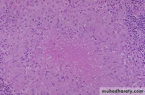 inflammation
