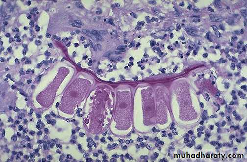 inflammation