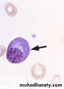 inflammation