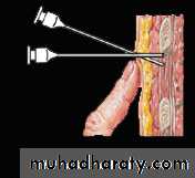2nd Lecture The Intercostal Muscles