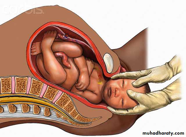 diabetes mellitus in pregnancy