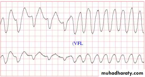 diuretics