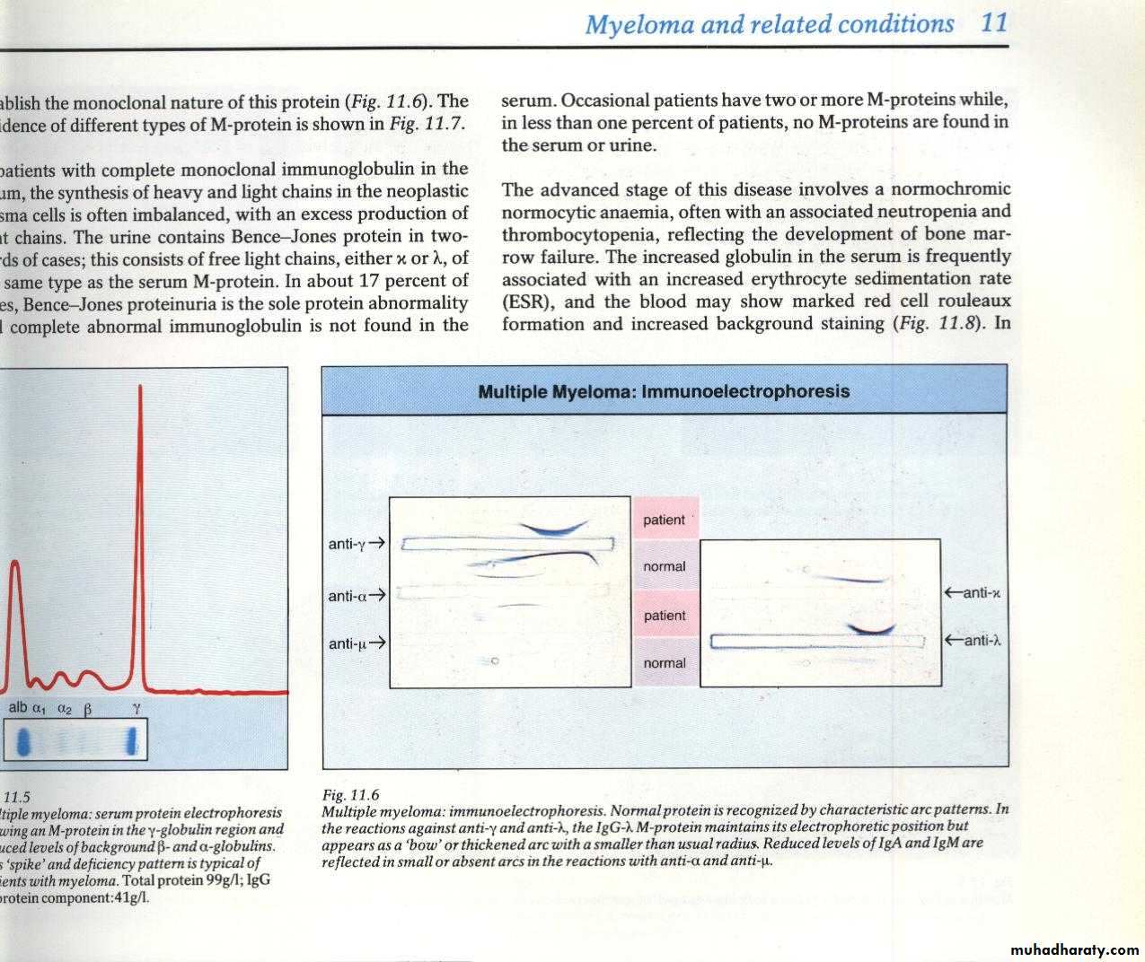 hematology