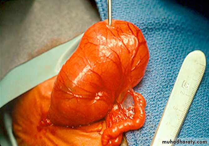 introduction to pediatric surgery