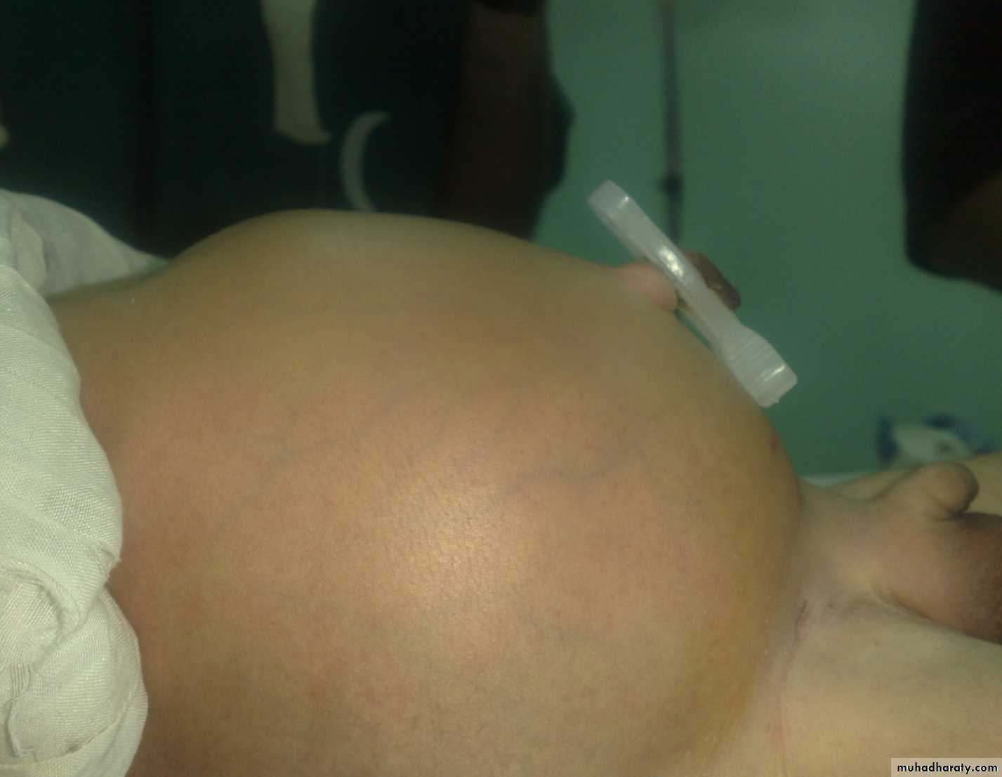 introduction to pediatric surgery
