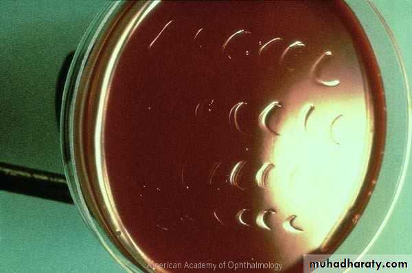 cornea