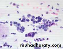 premalignant conditions of cervix