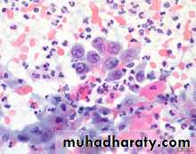 premalignant conditions of cervix