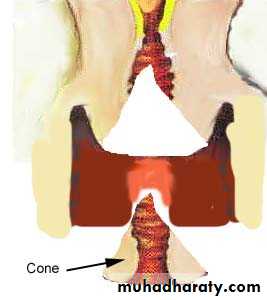 premalignant conditions of cervix